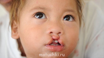 Капельки добра - longest-journey-preop-350.jpg