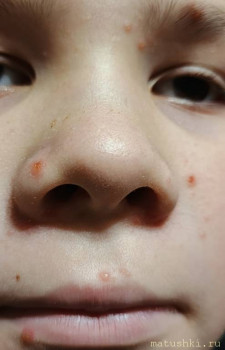 Прошу молитв о ребёнке - IMG_20260109_162901_002.jpg